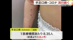 手足口病 宮城県内で微増…新型コロナとともに流行続く 「お盆明けは警戒を」県が対策呼びかけ