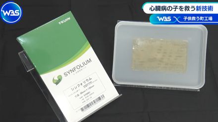 「下町ロケット」題材にも　心臓病の子を救う“新技術”開発の裏側【WBSクロス】