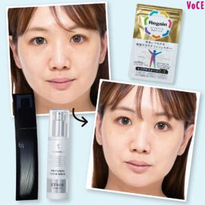 肌が黄ぐすむ！【抗糖化】スキンケア＆生活習慣を医師が解説