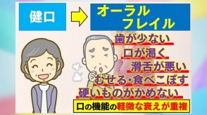 【死亡リスクも】心身の不調にもつながる口の衰え「オーラルフレイル」　症状に早めに気づくためのサインや改善策とは？