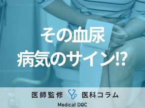 「血尿」が出る原因はご存じですか? 考えられる病気や対処法も医師が解説!