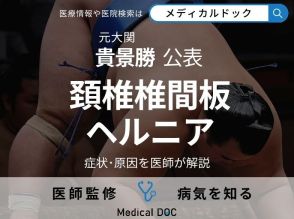 元大関・貴景勝 「頚椎椎間板ヘルニア」と大相撲協会が公表 症状・原因を医師が解説