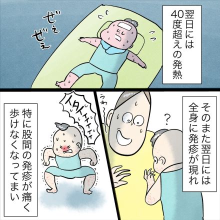 【漫画】やせ細って痛々しい…3歳息子が”手足口病”に「見るのもつらいですよね」【作者インタビュー】