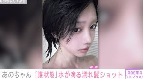 「誰状態」あのちゃん、水が滴る“濡れ髪”ショットを披露 「かっこいい」「ちょっとLに似てる」と反響