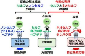 「ネオセルフ」への攻撃で症状　自己免疫病の仕組み解明　大阪大