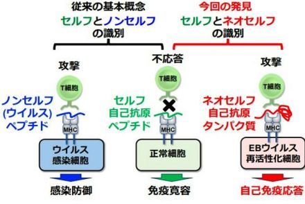 「ネオセルフ」への攻撃で症状　自己免疫病の仕組み解明　大阪大