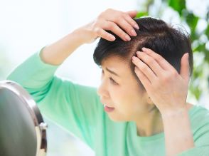 50代から急増する薄毛の悩み！薄毛危険度チェックで確認＆早めの対策を